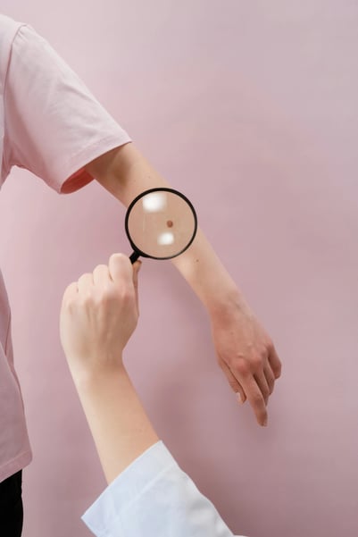 Close up of mole on arm with doctor holding magnifying glass