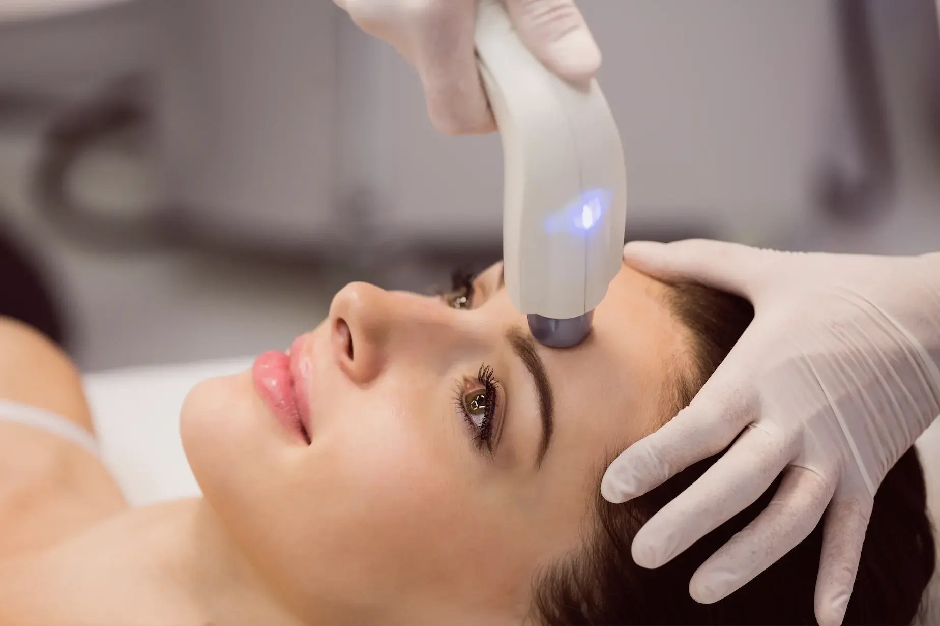 Laser hair removal for face