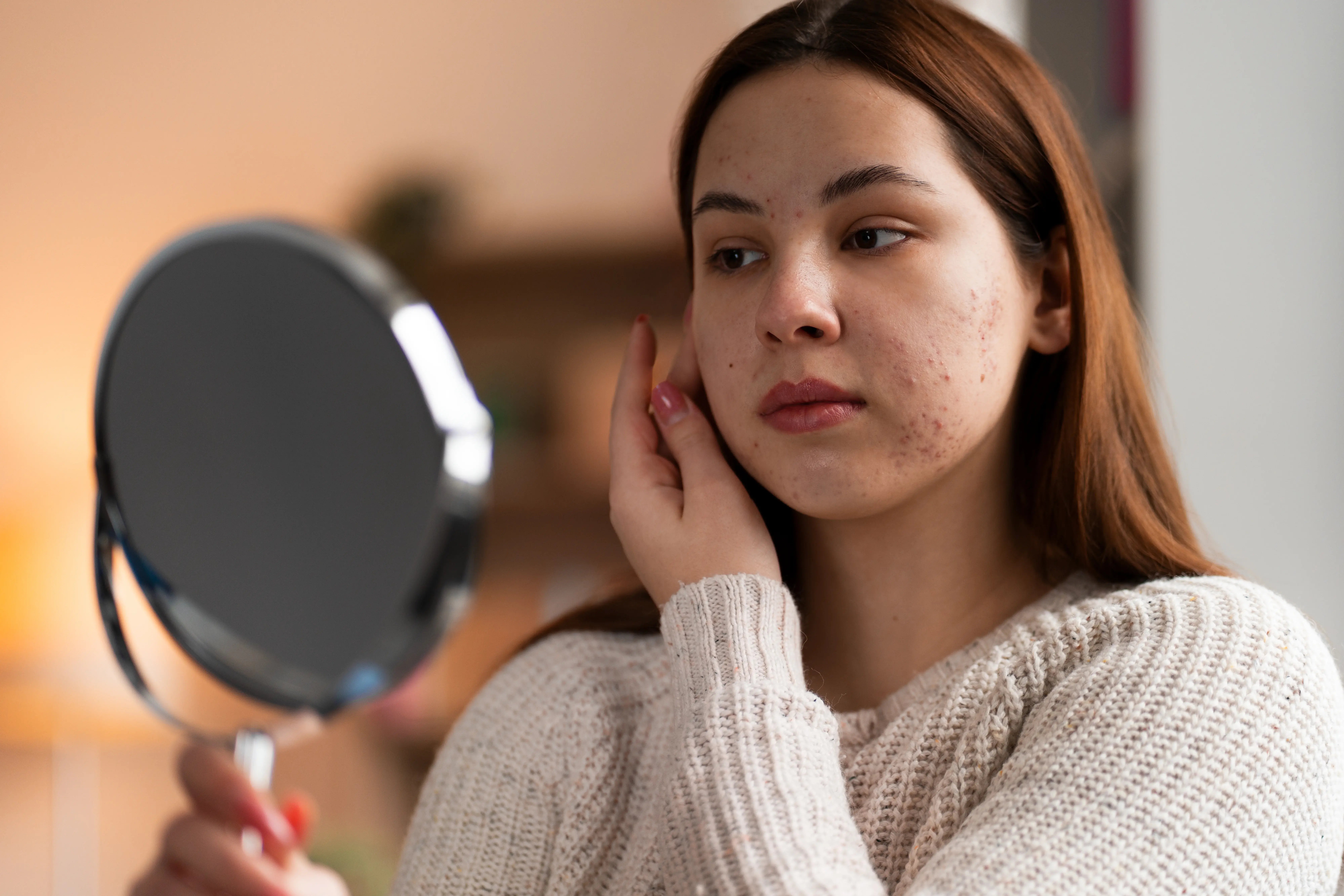 Person with acne looking in handheld mirror
