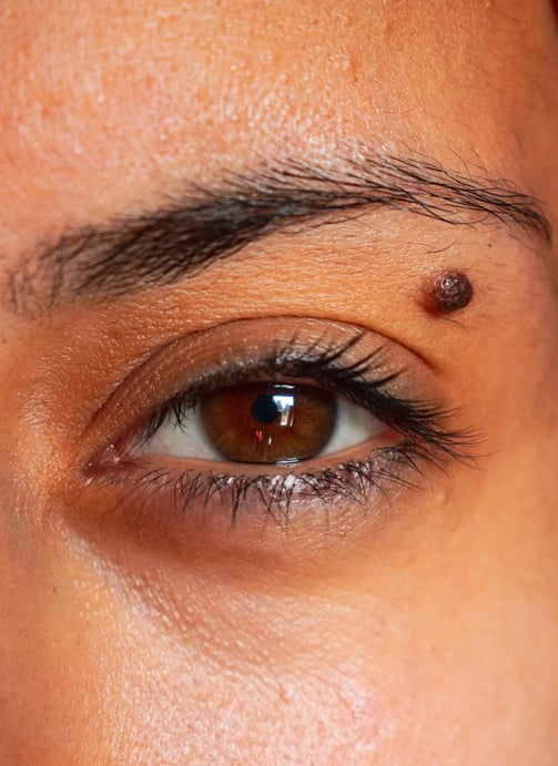 advantages of retinol