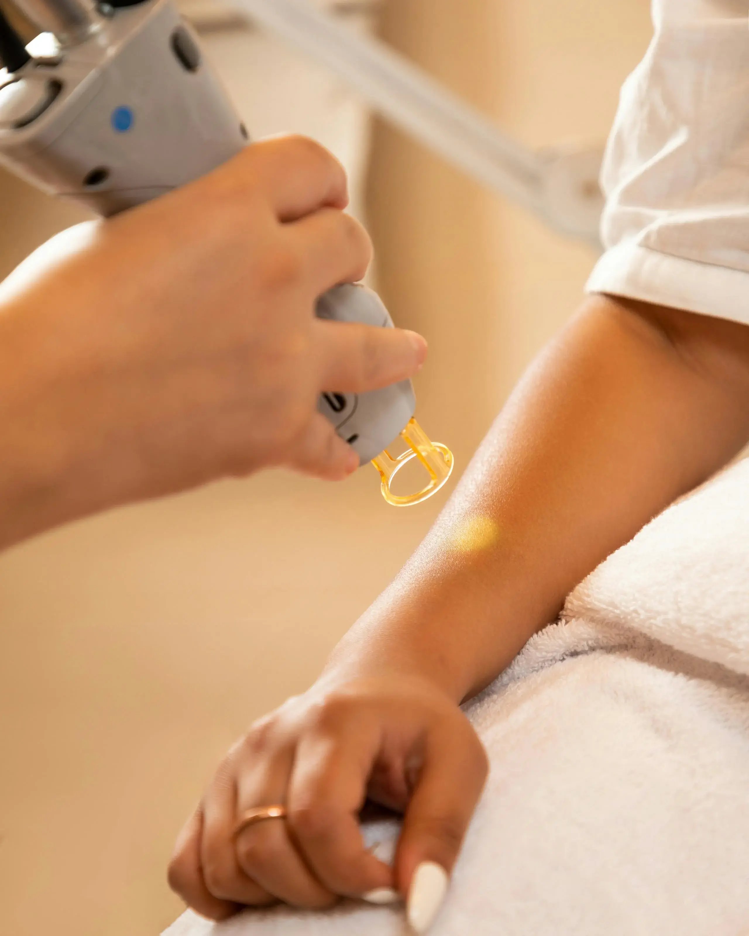 close up of laser hair removal on arm 