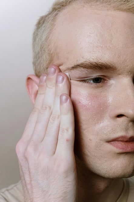 closeup of man suffering with facial redness