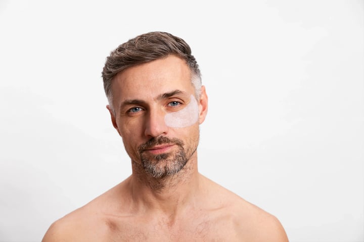 man after getting dermal fillers-1