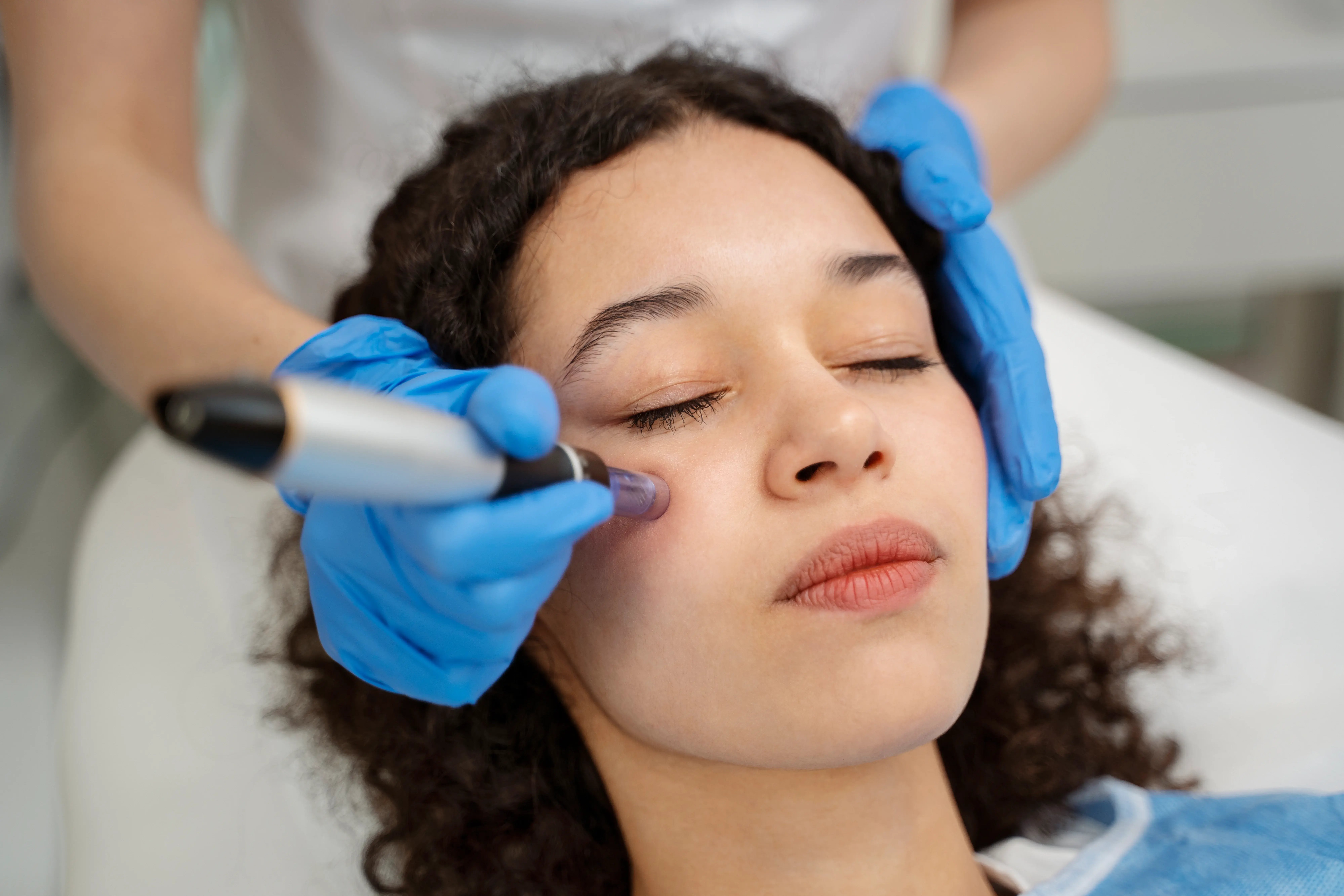 patient undergoing a laser treatment for acne