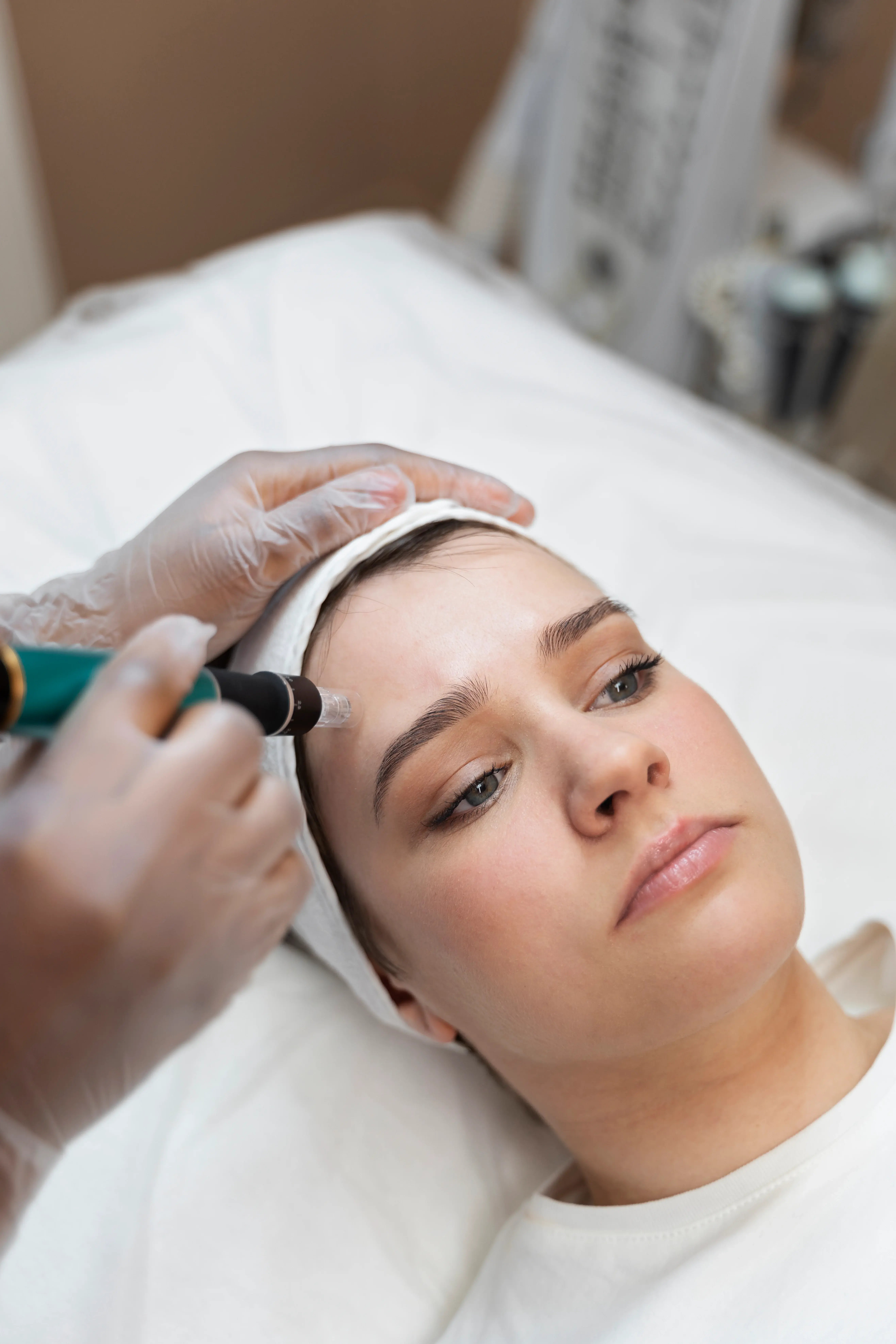 women getting microneedling treatment